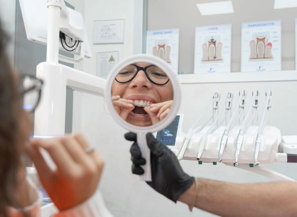 A cosa servono le mascherine per i denti 2 A cosa servono le mascherine per i denti
