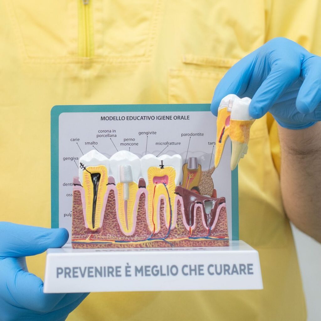 Endodonzia 1 devitalizzazione dente a Torino