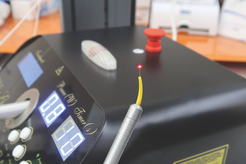 Sonda Laser